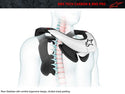 ALPINESTARS 护颈 Bionic SB Neck Suppert
